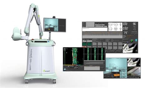 Image Guided Superficial Radiotherapy .